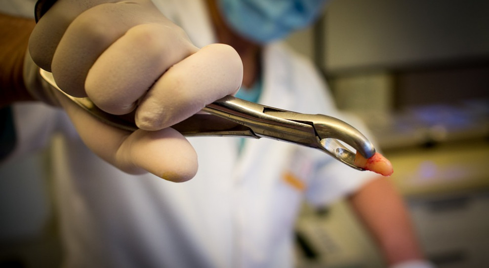 51-letni dentysta wyrywał ludziom zdrowe zęby. Pójdzie do więzenia na osiem lat. (fot. pixabay) Dentysta-sadysta pójdzie siedzieć. I nie będzie już "leczył" zębów