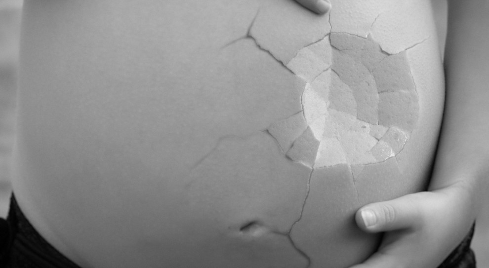 Monika Rosa wnioskuje o ułatwienie procedur dla kobiet, które poroniły (fot. Jane Lund z Pixabay) Posłanka chce uproszczenia przepisów dla kobiet po poronieniu
