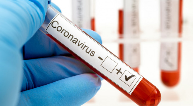Systemem codziennych testów objęci zostaną m.in. funkcjonariusze policji, straży granicznej, straży pożarnej (fot. Shutterstock) Codzienne badanie zamiast kwarantanny. Znaleźli sposób na absencje pracowników