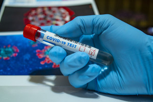 Studenci medycyny zostaną przebadani na koronawirusa